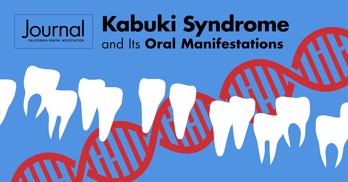 Case report on the oral manifestations of Kabuki syndrome featured 